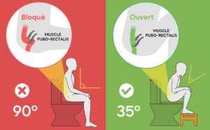 angle ano rectal tabouret toilettes